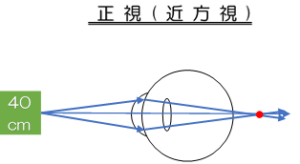 正視近方視