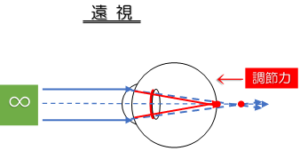 遠視(調節力)